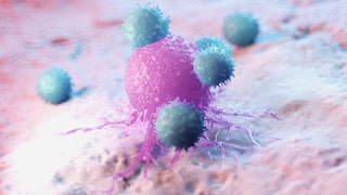 Krebszelle mit Immunzellen unter dem Mikroskop
